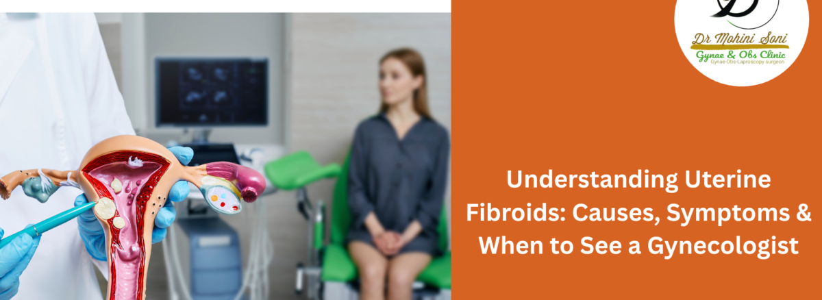 uterine fibroids