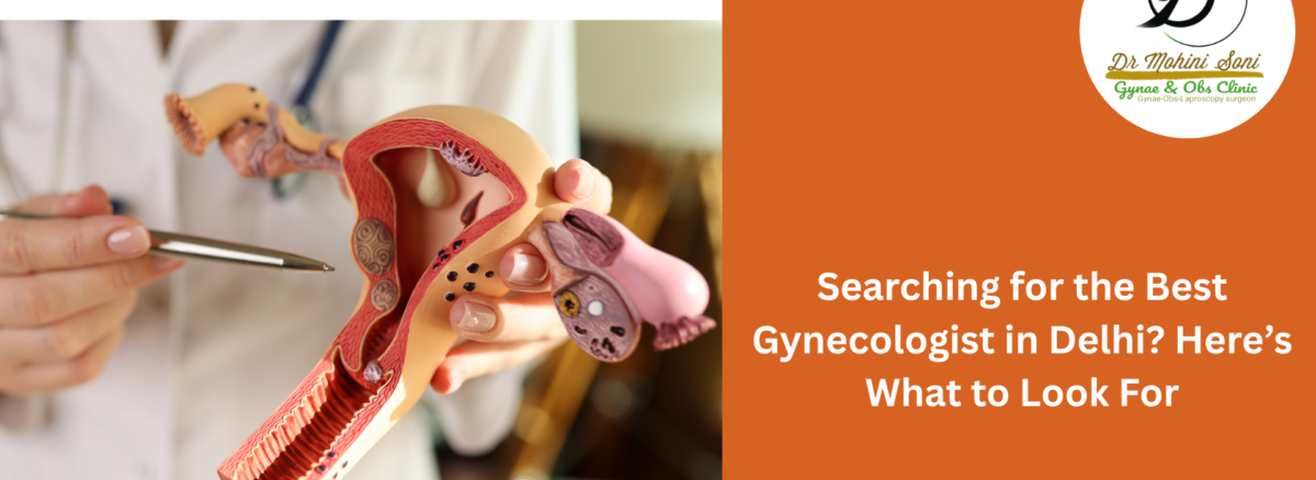 best gynecologist in delhi