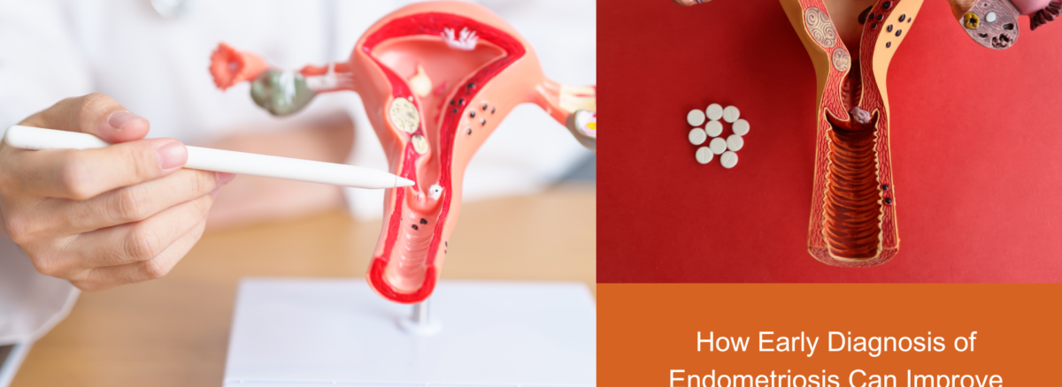 How Early Diagnosis of Endometriosis