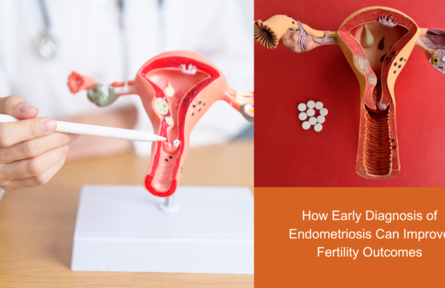 How Early Diagnosis of Endometriosis