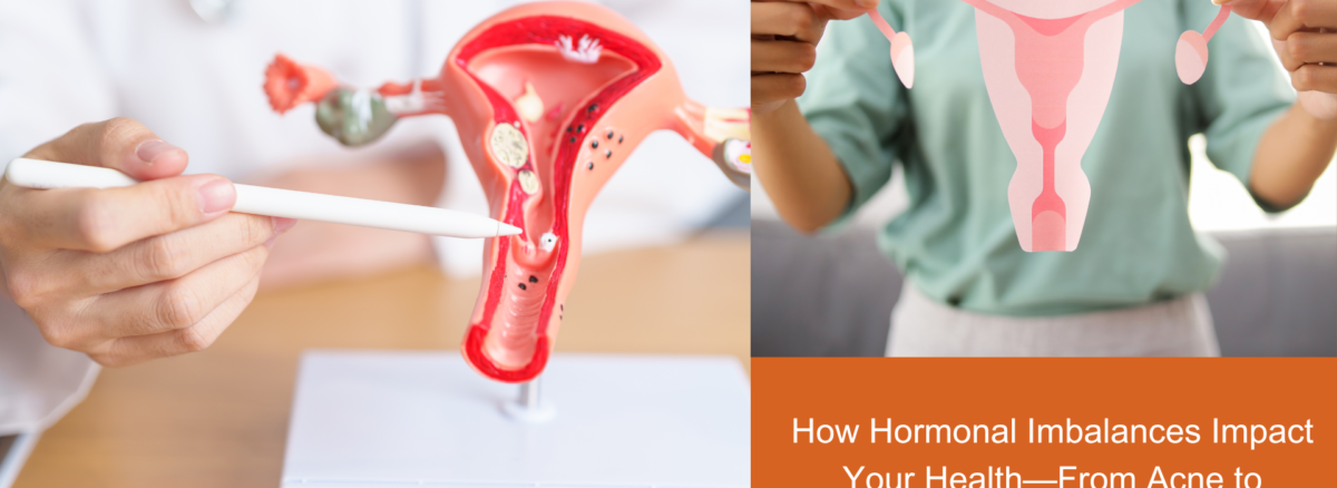 How Hormonal Imbalances Impact Your Health—From Acne to Infertility