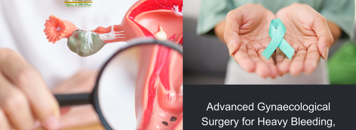 Advanced Gynaecological Surgery for Heavy Bleeding