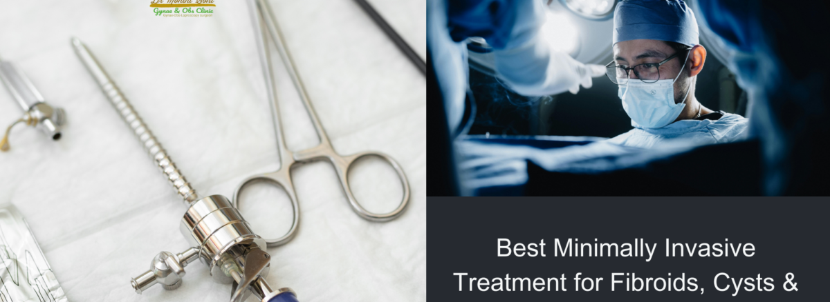 Best Minimally Invasive Treatment for Fibroids