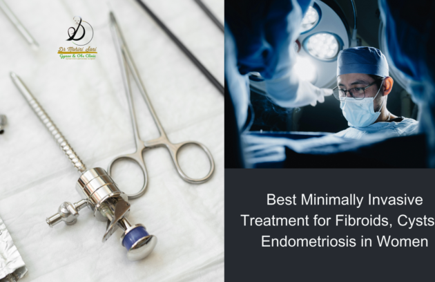 Best Minimally Invasive Treatment for Fibroids